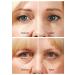 ROX Eye Lifting - TV Rox Anti Eye Wrinkle Booster | International Shipping Available - Buy Online on GoSupps.com