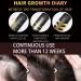 Hair Growth Oil Thinned Hair Liquid Grow Hair Deeply Nourishing Scalp Stimulates Hair Growth Trengthen Hair Roots Moisturize & Repair Dry Damaged Hair Care Hair Growth Serum for All Hair Types - Buy Online on GoSupps.com