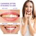 Purple Teeth Whitening Toothpaste - Effective Tooth Spot Removal & Color Correction Serum for Adults - 60g (1 Pack) | Brighten Your Smile - Buy Online on GoSupps.com
