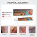 Decubitus Wound Cream 20 G 2 Pieces Fast-Acting Decubitus Wound Treatment Cream Remove Rot Myogenic Infection Protection Ointment for Bed Sores Wound Healing Body Care - Buy Online on GoSupps.com