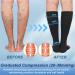 Knee High Medical Compression Socks 20-30 mmHg for Men & Women | Open Toe Circulation Support for Varicose Veins DVT Sports & Travel - Black Small - Buy Online on GoSupps.com