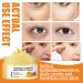 Turmeric + Vitamin C Eye Cream | Brightening Hydrating & Anti-Aging | Dark Circle Relief & Elasticity Treatment - Buy Online on GoSupps.com
