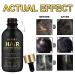 5% Minoxidil Hair Growth Oil for Men & Women - Biotin Serum for Hair Regrowth, Thicker Fuller Hair - 2.02 oz - Buy Online on GoSupps.com