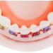 Buy DeltaDent Mouthguard for Braces - Replace Orthodontic Wax & Enhance Comfort with Lip Pads - Best Solution for Orthodontics - Buy Online on GoSupps.com