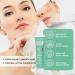 Acne Cream Anti Acne Face Cream for Acne Treatment and Spot Treatment Pimple Treatment Gel Cream For Face Blemishes & Blackheads Reduce Redness Moisturiser Fade acne marks Oil Control - Buy Online on GoSupps.com