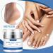 Urea Foot Cream - 45% Urea Cream for Feet - Cracked Heel Repair Cream - Foot Nourishing Cream for Dry Skin Deep Moisturizing - 50g Callus Remover Nourishes Soften for Feet and hand - Buy Online on GoSupps.com