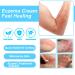 Eczema Relief Cream | Moisturizing Lotion for Eczema-Prone Skin | Full Body Moisturizer with 1% Hydrocortisone - Buy Online on GoSupps.com