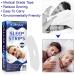 Moulis 90Pcs Sleep Strip Mouth Tape for Improved Nighttime Sleeping and Instant Snoring Relief - Buy Online on GoSupps.com