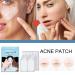 Buy Ikasus Acne Patch - 80 Hydrocolloid Pimple Dots with Tea Tree & Calendula Oil | Invisible Acne Absorbing Covers - 5 Sizes for Face & Body - International Shipping Available - Buy Online on GoSupps.com