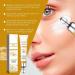 Instant anti-dark circles and wrinkles cream Eye Contour Cream Retinol Anti-Puffiness Under Eye Cream 15g Anti-Wrinkle Eye Contour Care Serum anti-puffiness under the eyes dark circles under the eyes (1pc) - Buy Online on GoSupps.com