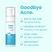 Teen Skin Face Wash - Gentle Foaming Facial Cleanser for Acne Prevention - Natural Ingredients - 5 oz - Buy Online on GoSupps.com