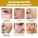 JOYVOIDX Bee Venom Anti-Aging Face Cream with Collagen Hyaluronic Acid and Niacinamide Wrinkle Reducing and Firming Formula for Youthful Skin Nourishing Moisturizer 1.7 Fl Oz - Buy Online on GoSupps.com
