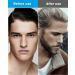 Replacement Head for Series 3 Electric Shaver | Men's Razor Replacement Shear & Compartment (21B) | Compatible & Durable - Buy Online on GoSupps.com