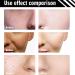 2PCS BB Cream Medium & Light SPF 50 Tinted Moisturizer with Snail Extracts - Buy Online on GoSupps.com