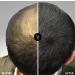 LDN Professional - Hair Fibers Hair Loss Concealer Densificateur de cheveux Cheveux fins et clairsem s Zone de calvitie-effet visible imm diat - 22g (Marron Clair) - Buy Online on GoSupps.com