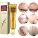 Scar Repairing Gel with Easy-to-Use Soft Texture Plant Extract Ingredients for Refreshing Skin - Reduces Scars & Spots - 30g/1.1oz - Buy Online on GoSupps.com