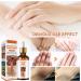 Dark Knuckles Remover From Hand Dark Spot Correcting Glow Serum Lightweight Body Oil Whitening Serum Hyperpigmentation Dark Spot Remover For Hand & Foot & Body Brightening Body Oil For Darkness 1pc - Buy Online on GoSupps.com