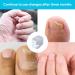 Nail Fungus Cleaning Laser Device Anti Fungal Laser Nail Fungus Laser Treatment with Time Display for Damaged Discolored Thick Toenails & Fingernails Nail Therapy for Onychomycosis Easy to Use at H - Buy Online on GoSupps.com