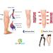 GPAR Premium Medical Compression Stockings Class 2 | Unisex 23-32 mmHg Thigh-High for Varicose Veins Edema & Leg Pain | 3XL Beige - Buy Online on GoSupps.com