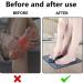 Buy EMS Foot Massage Device - Portable Foldable Intelligent Massage Mat with 8 Modes & 19 Frequencies for Blood Circulation & Muscle Pain Relief | International Shipping Available - Buy Online on GoSupps.com