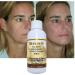 Saggy Neck Double Chin Reducer | Snail Slime Skin Firming Gel with Natural Ingredients | Shop Now for Youthful Skin - Buy Online on GoSupps.com