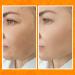Buy BEE and YOU Anti Aging Face Cream Serum - Vitamin C Moisturizer & Skin Brightener with Bee Propolis | 1 fl oz - Shop Internationally - Buy Online on GoSupps.com