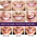 Purple Teeth Whitening Toothpaste - Effective Tooth Spot Removal & Color Correction Serum for Adults - 60g (1 Pack) | Brighten Your Smile - Buy Online on GoSupps.com