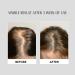 Hair Growth Serum with Redensyl Anagain & Procapil - Hair Fall Control for Men & Women | 1 FL Oz - Buy Online on GoSupps.com