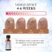 Extra Strength Toenail Fungus Treatment - Fast Acting Nail Repair Liquid for Discolored Nails with Nail File - Buy Online on GoSupps.com