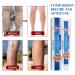 Veinhealth Blue Light Therapy Set for Varicose Veins - Effective Treatment Cream for Legs - Buy Online on GoSupps.com