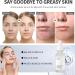10% Niacinamide Serum + 1% Zinc Serum Moisturiser Face Serum Anti Aging Serum for Face Brightening Serum for Face Face Oils and Serums Control Excess Oil Dull Skin and Redness for All Skin Types - Buy Online on GoSupps.com