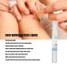 Skin Repair Liquid Bandage 5ml - Promotes Healing, Quickly Dries, Waterproof Wound Care - Buy Online on GoSupps.com