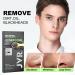 JVR Nose Strips for Blackhead Removal | Deep Cleansing Pore Strips with Charcoal & Witch Hazel | 10 Count for Oily Skin - Buy Online on GoSupps.com
