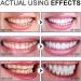 Probiotic Teeth Whitening Powder - Mint Formula for Deep Clean & Fresh Breath | International Shipping Available - Buy Online on GoSupps.com