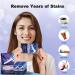 MySmile 56 No Sensitivity Teeth Whitening Strips - 28 Day Treatment for White, Enamel Safe Smile - Buy Online on GoSupps.com