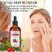 Aeshory Cold Pressed Rosehip Oil for Face 100ml 100% Pure Natural Rosehip Seed Oil Hydrating Nourishing & Moisturising for Skin Hair Nails and Body - Buy Online on GoSupps.com