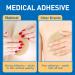 Medical Silicone Scar Sheets 8 Pack - Breast Scar Treatment for Post Surgery - Scar Removal & Reduction Supplies - Buy Online on GoSupps.com