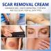 Scar Removal Cream - Natural Scar Repair for Acne Stretch Marks & More | Effective for Old & New Scars on Face & Body - Buy Online on GoSupps.com