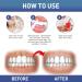 Gum Instant Treatment Gel Gum Instant Soothing Gel Perispot Gum Gel for Teeth Whitening Essence Pen - Buy Online on GoSupps.com