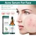 Acne Scar Fading Serum Pore Minimizing Hydrating Essence - Brightens & Repairs Skin Makes Skin Smooth Easy To Use(2PCS) - Buy Online on GoSupps.com