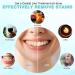 MYBYS Coconut Teeth Whitening Strips Kit - 56 Strips with Gel | Professional At-Home Whitening Treatment - Sensitivity-Free - Buy Online on GoSupps.com