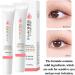 Double Eyelid Double Eyelid Shaping Cream Double Eyelid Styling Cream Long Lasting Invisible Double Eyelid Shaping Styling Cream Waterproof 2 Pieces - Buy Online on GoSupps.com