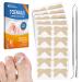 Ingrown Toenail Treatment  50Pcs No Glue Toenail Corrector Patch  Ingrown Toenail Removal Kit whit 2 Ingrown Toenail Tool  Protect and Repair Ingrown Nails Toenail