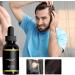 Hair Growth Oil | Dry Scalp Oil | Natural Nourishing Cold Pressed Moisturizing Organic Rosemary Oil 1.62oz for Hair Loss Promotes Zonto - Buy Online on GoSupps.com