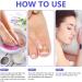 Toen il Correction Sticker 100Pcs: N il Repair P tches Restores Appearance of Discolored or Damaged Nails Foot Care - Buy Online on GoSupps.com