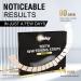 Non-Sensitive Teeth Whitening Strips - 56 Count Non-Slip Kit for Quick, Professional Results | Natural Coconut Flavor - Black & Golden - Buy Online on GoSupps.com
