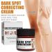 G neric Crema Para Manchas Oscuras En La Cara Crema Para Las Manchas De La Cara 60ml 1pcs Para Piel Entrepierna Manchas Codos Piernas Zonas Rodillas Cuello - Buy Online on GoSupps.com