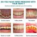 Instant Teeth Whitening Paint Gel - 15ml Tooth Paint for Stain Removal (2Pcs) | Color Correcting Gel for Bright Smile - Buy Online on GoSupps.com