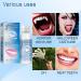 Snap-On Veneers Teeth Kit - Solid False Teeth for Missing Denture Gaps - Temporary, Confidence-Boosting Solution with Tooth Adhesive - Includes Travel Brush Holder Cup - White, One Size - Buy Online on GoSupps.com