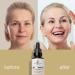 Gaia Body Care 5% Bakuchiol Oil Organic - Anti Aging Anti Wrinkle Reduces Fine Lines Smooths Skin Hydrates - Botanical Vegan - Natural Retinol Alternative Facial Oil (1oz Unscented) Unscented 1 Fl Oz (Pack of 1) - Buy Online on GoSupps.com